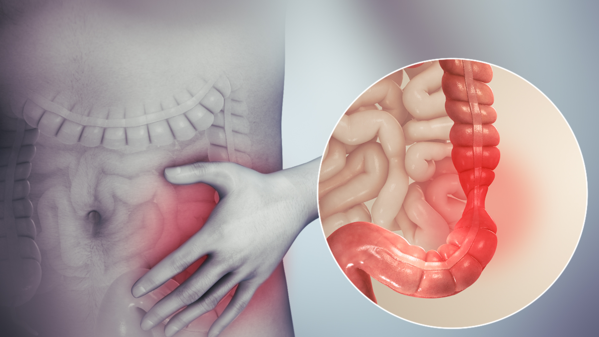 5 طرق لعلاج ألم القولون